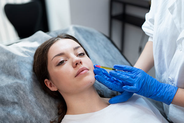 PRP for Face Treatment